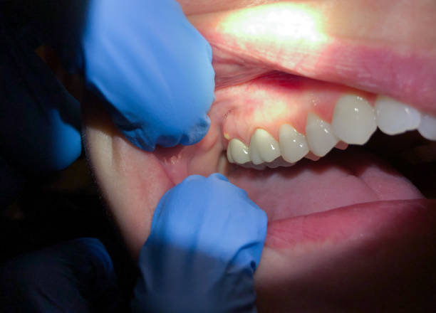 Best Emergency Treatment for Jaw Pain or Injury in Gulf Breeze, FL